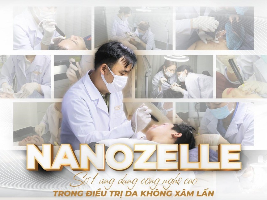 nanozelle-manh-ghep-quan-trong-khi-kinh-doanh-spatmv-3-1698145089.jpg