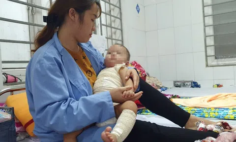 Con bị hoại tử sau khi mẹ đưa đến thầy lang chữa bỏng